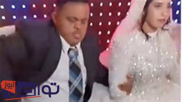 التحقيق في زواج شاب من متلازمة داون