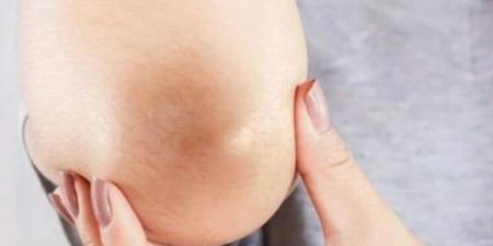 حصري فقط على تواصل نيوز - مكونات لا تخطر ببالك تحيي ركبتيك وأكواعك - تواصل نيوز