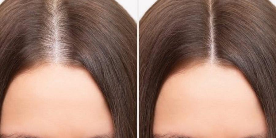 إخفاء تساقط الشعر، منتجات فورية لمظهر كثيف - تواصل نيوز