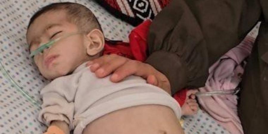 وفاة طفلة بسبب المجاعة والجفاف في خان يونس - تواصل نيوز