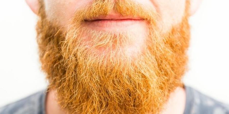 أسباب ثعلبة الذقن وطرق العلاج - تواصل نيوز