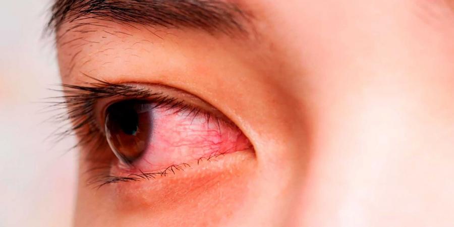 احنا بتوع الجديد - اضطراب مناعي مزمن.. أثر مرض شوجرن على جودة الحياة - تواصل نيوز